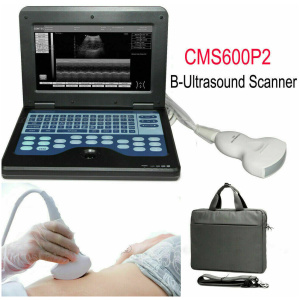 Ordinateur portable de scanner d’ultrason